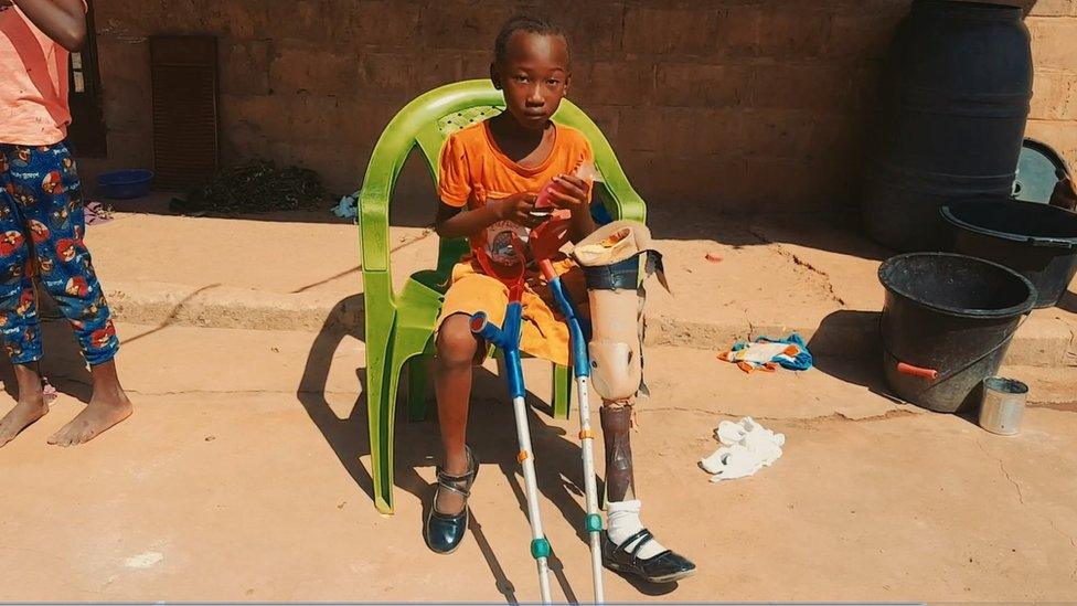 Wudeh with one of Euan's old prosthetic legs