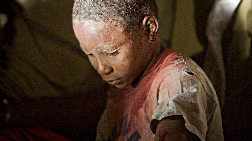 An injured Haitian receiving medical care in Port-au-Prince