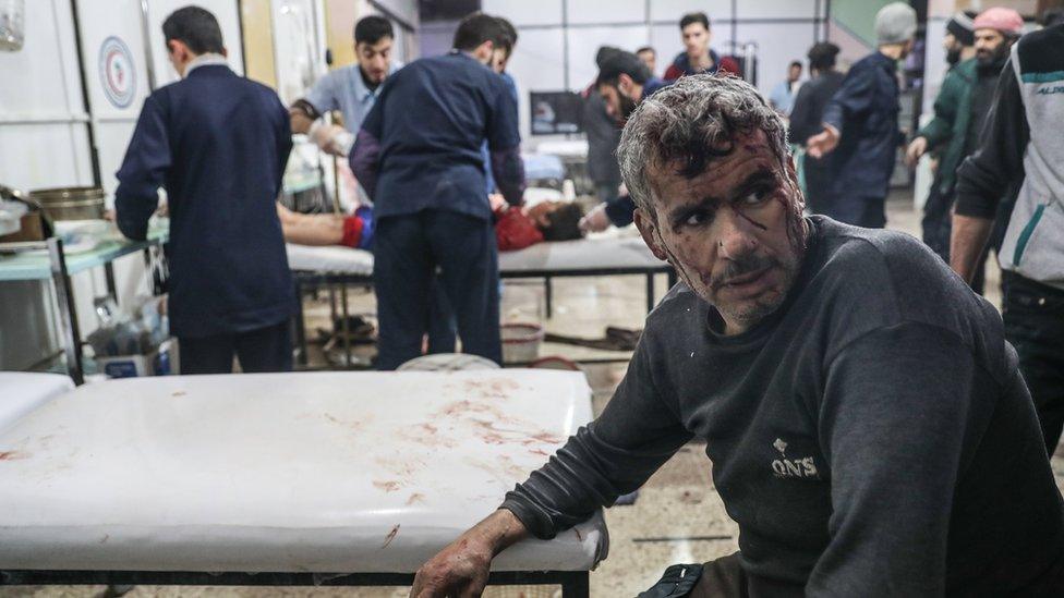 People injured in an attack on the town of Misraba, in the Eastern Ghouta outside Damascus, receives treatment at a hospital (4 January 2018)