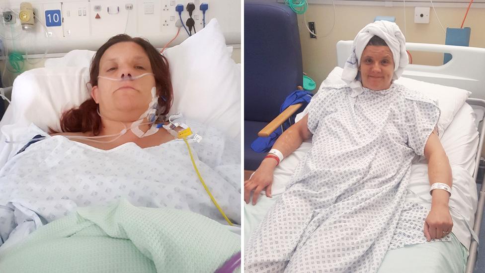 Mandy in hospital shortly after surgery (left) and a few days later