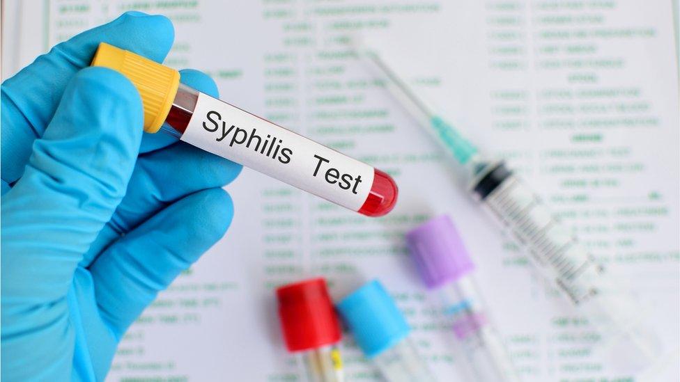 syphilis test