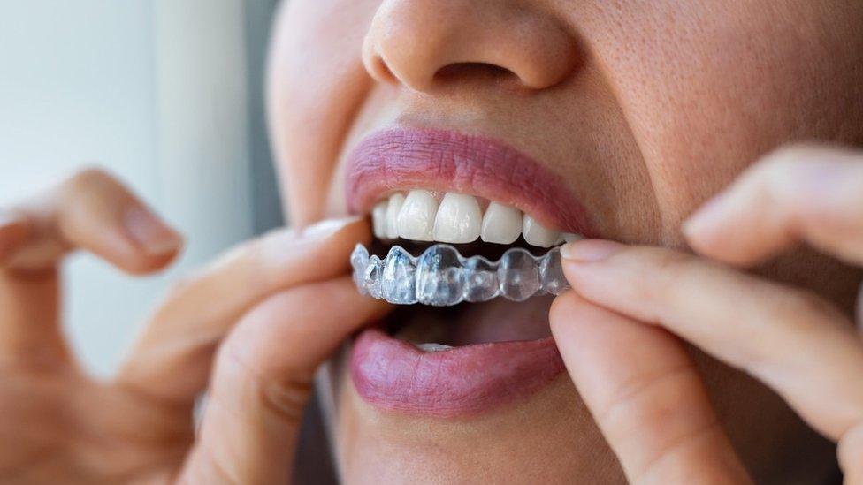 Woman putting in clear aligners