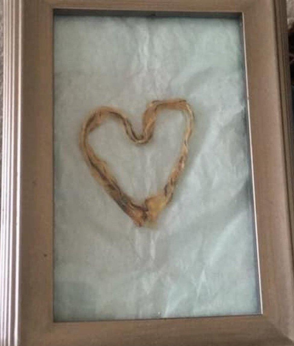 A framed picture containing a human umbilical cord shaped like a heart