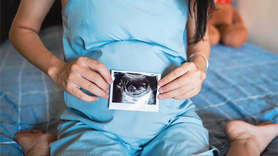 pregnant women holding a scan up to her tummy