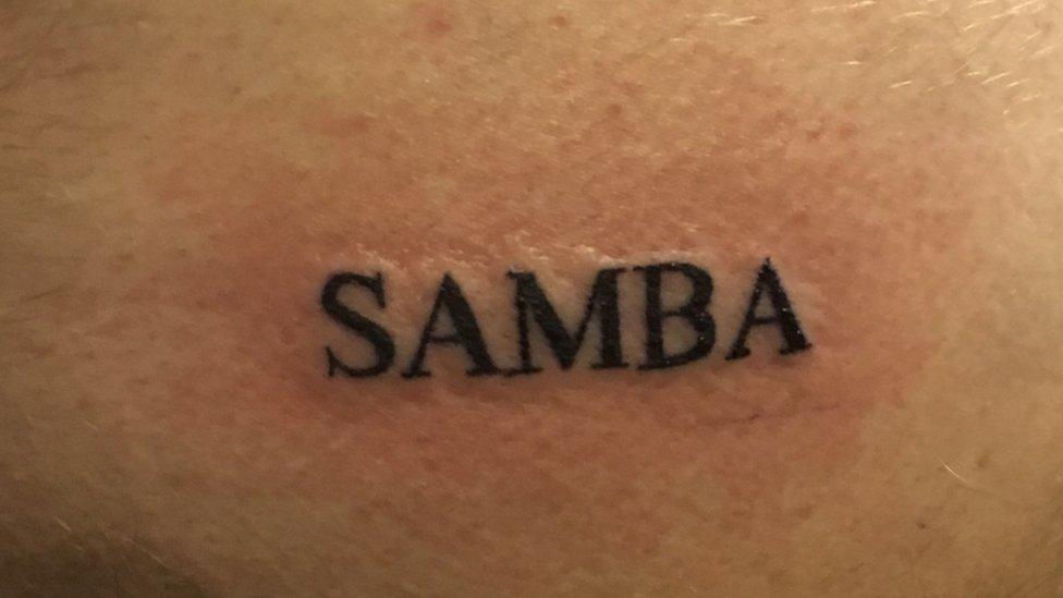 Nottingham Forest goalkeeper impressed by fan's cheeky tattoo - BBC News