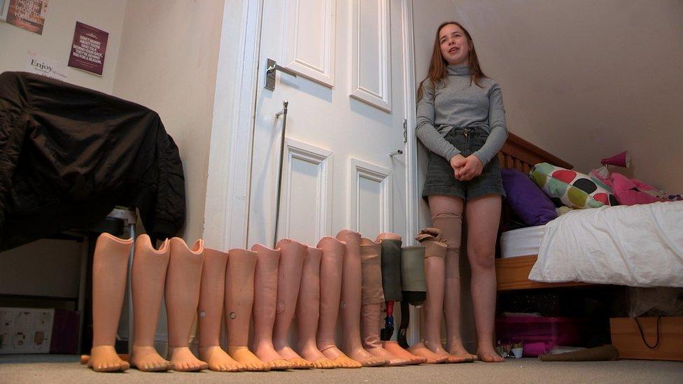 Iona Hay has built up quite a collection of prosthetic legs