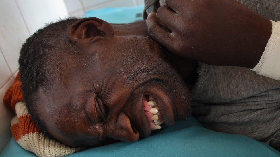 Fredrick Shaba, a local official for the Zimbabwean opposition party Movement for Democratic Change is treated for stab wounds June 20, 2008 in Bulawayo, Zimbabwe.