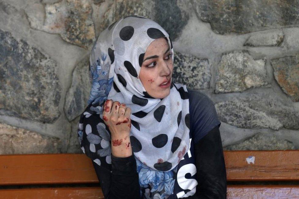 An injured woman sits outside a hospital in Kabul. Photo: 31 May 2017