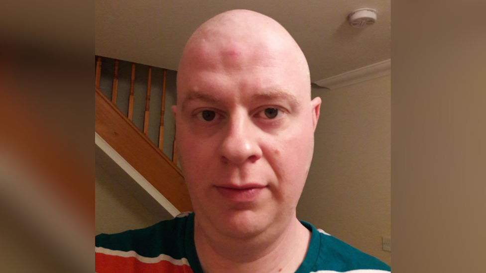 A bald man looking solemn, wearing a stripy green, red and white T-shirt.