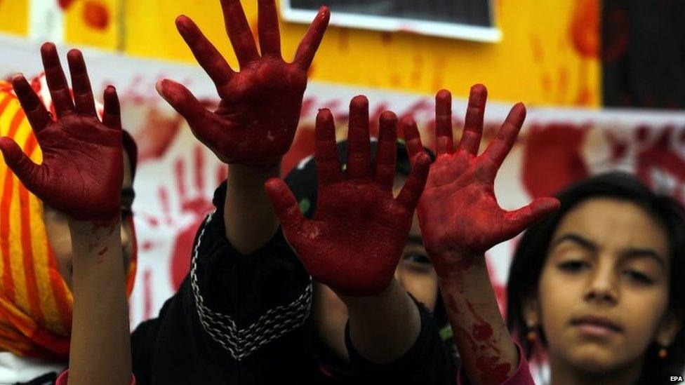 Yemenis loyal to the Houthi movement show their red-painted palms, a symbol of silent protest, during a protest against the Saudi-led military operations in the capital Sanaa (09 July 2015)
