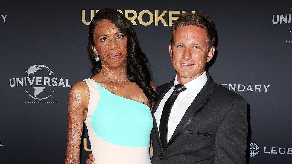 Turia Pitt and her husband Michael Hoskin