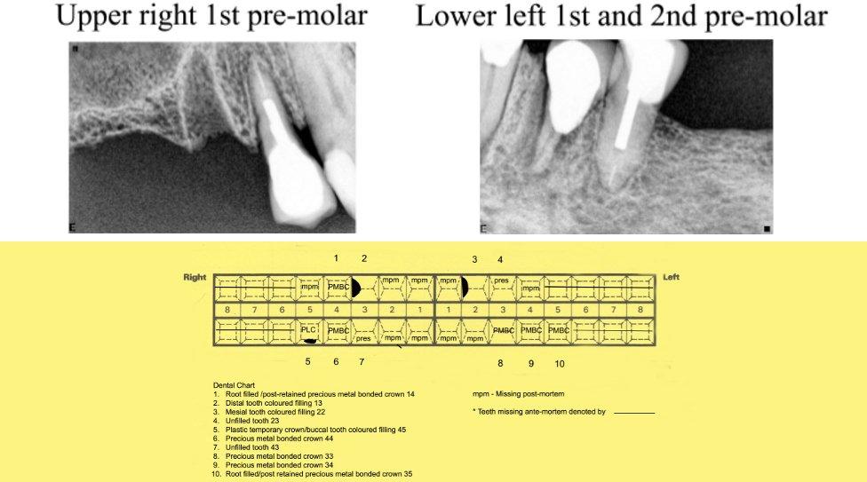 Dental records