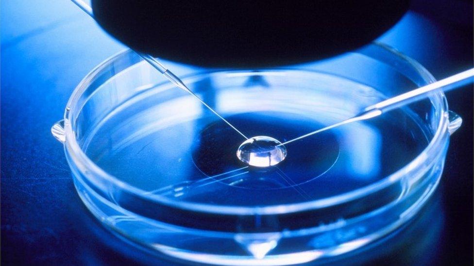 Sperm selection using the CISS method. Two micro- needles are inserted into a droplet of semen to capture fertile sperm by the CISS method (Computer Imaging Sperm Selection). This is a step in the process of in vitro fertilisation