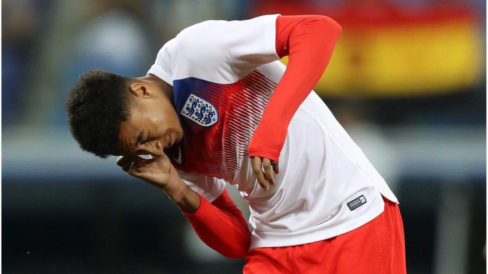 Lingard troubled by bug