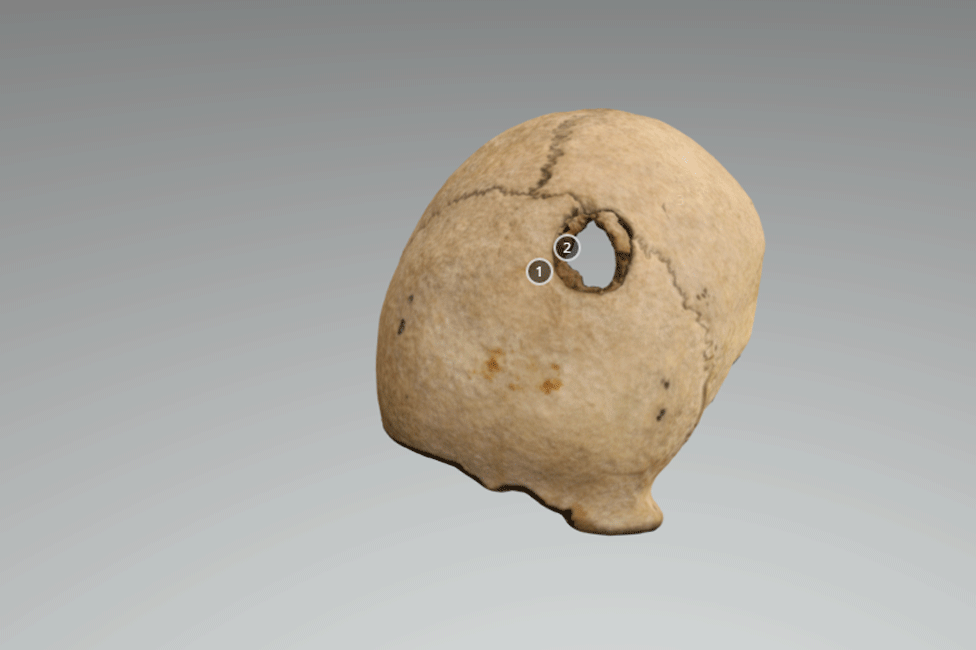 3D digital model of skull