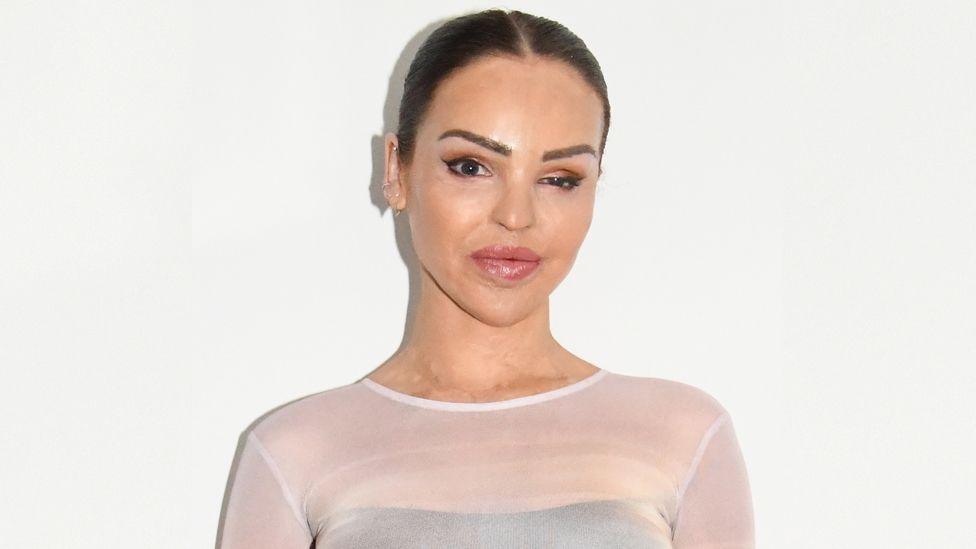 Katie Piper posing for a photo, she has slicked-back hair and is smiling at the camera