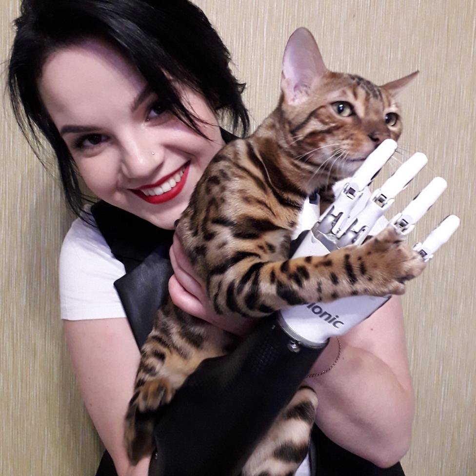 Margarita Gracheva with her prosthetic hand