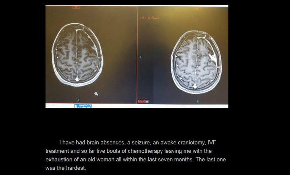 brain scans