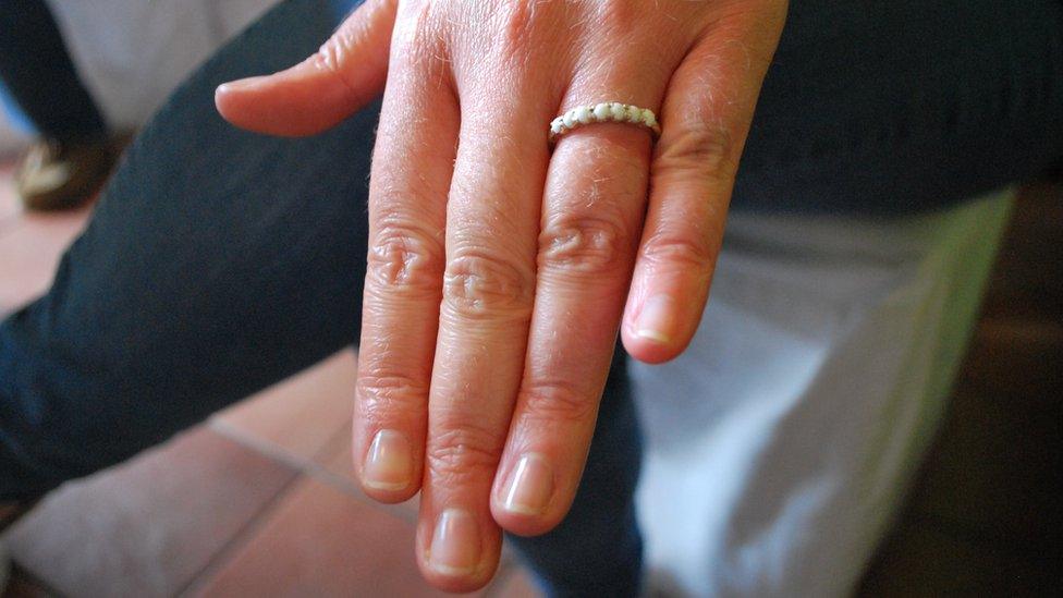 Kelly Bramwell wearing a ring made from breast milk on her hand