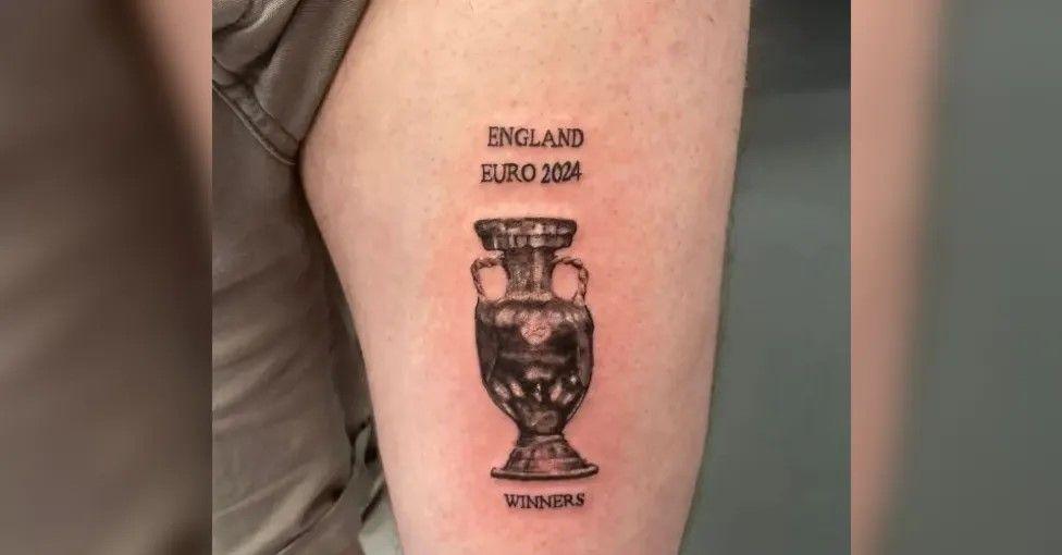 A leg with a black tattoo of a trophy with the words "England Euro 2024" written above it and the word "Winners" below it. The skin around the tattoo is reddened