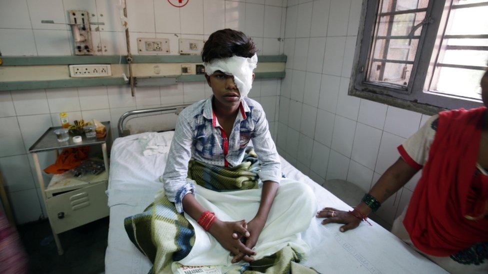 A child sits in Amritsar hospital with a bandage around his head