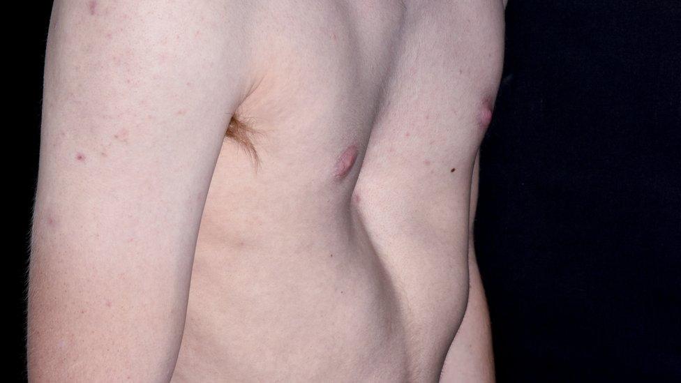 The chest of a 19-year-old male patient