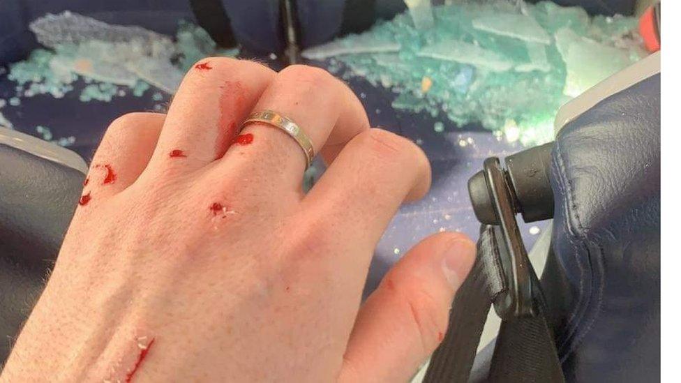 cut hand and shattered glass following bus accident