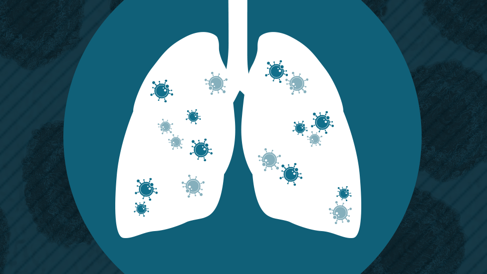 Illustration showing lungs and virus