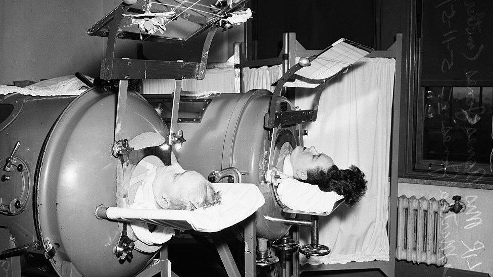 Polio patients in the breathing apparatus known as "the iron lung"