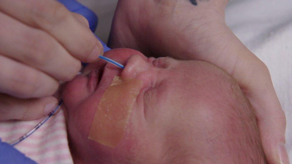 Katie Crossley inserting a tube for her baby to feed