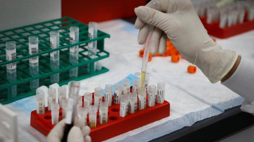 Test tubes being used in a lab setting