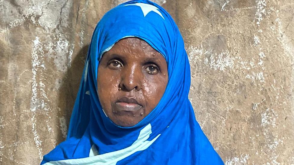 Ayaan Mohamed in Galkayo