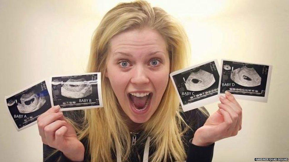 Ashley Gardner holds four ultrasound scan photos