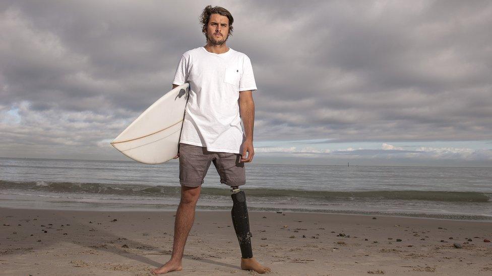 Chris Bowes on the beach with a surfboard