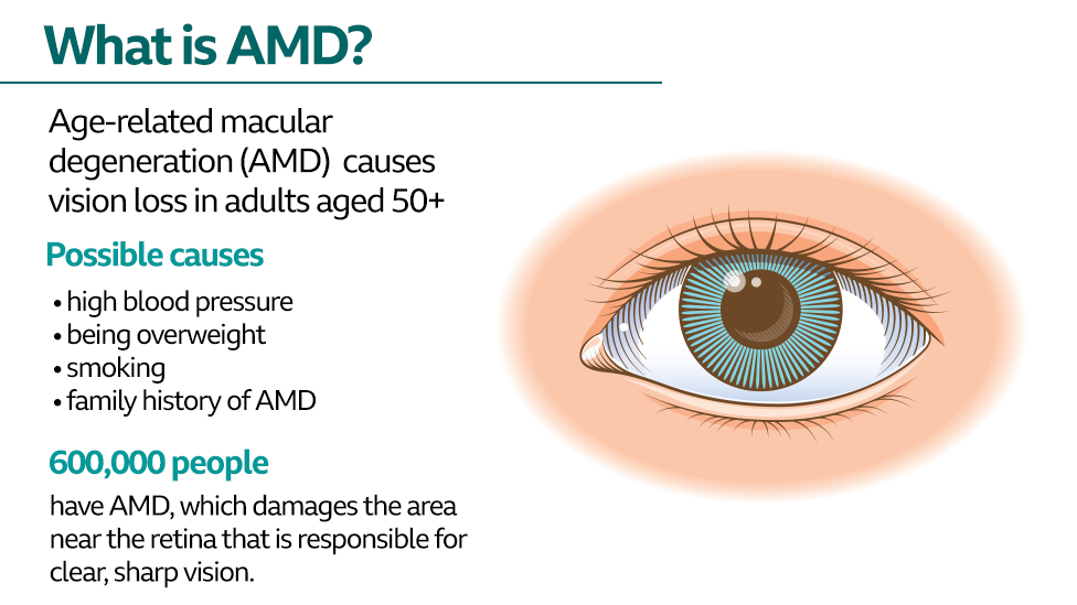 AMD