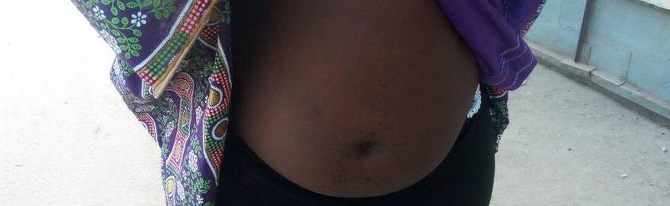 Woman with swollen stomach