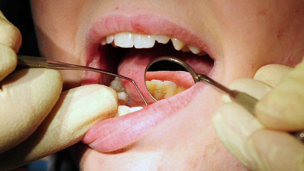 Dental treatment, a close-up of a dentist's hand with rubber globes examining teeth with a small mirror