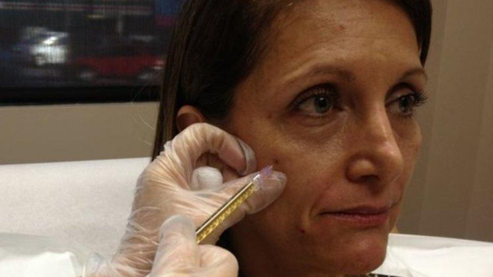 A woman in Los Angeles having a Vampire facial