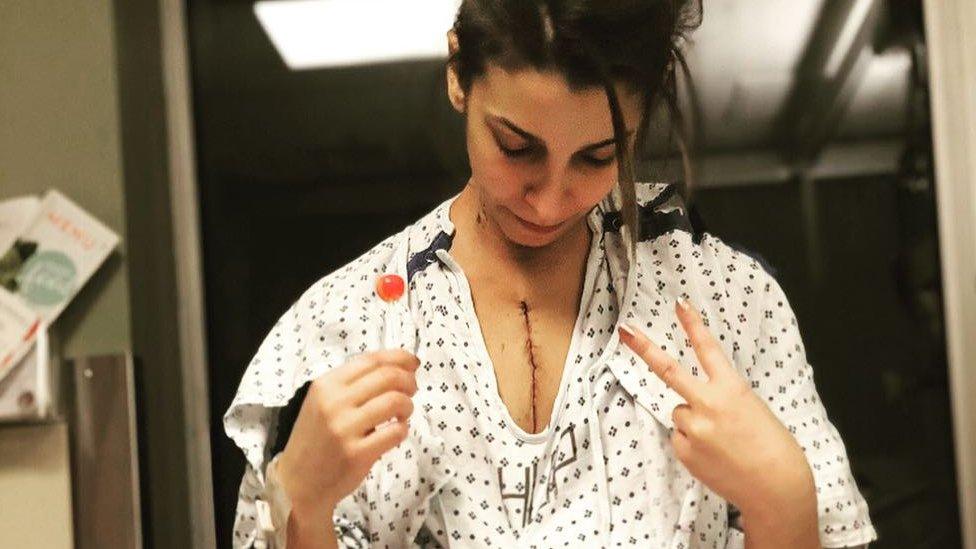 Alin Gragossian in a hospital gown with a scar on her chest