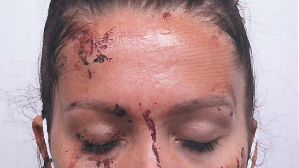 A close up of Kiena Dawes forehead and eyes showing drips of blood and a gash on her head