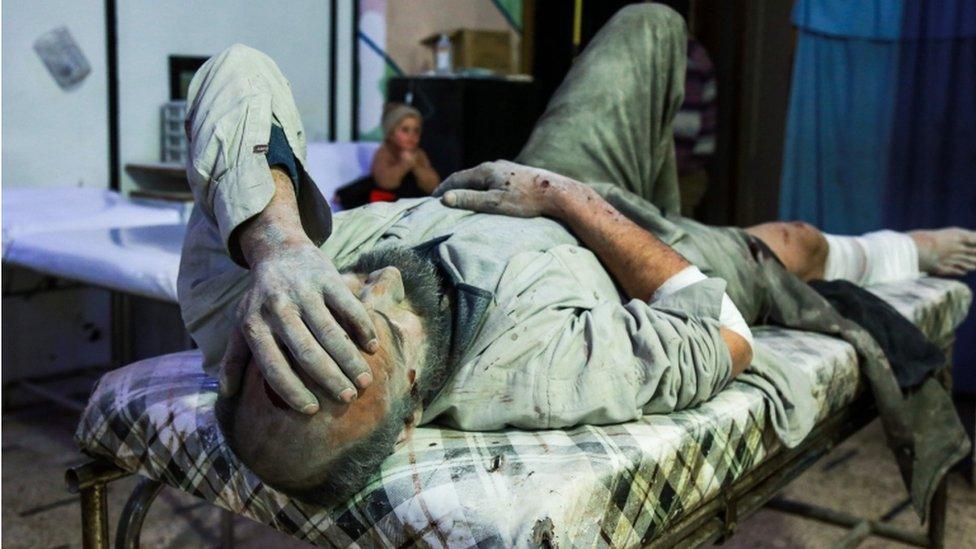 A Syrian man covered in dust lies on a bed awaiting medical attention at a makeshift hospital in Douma, in the Eastern Ghouta