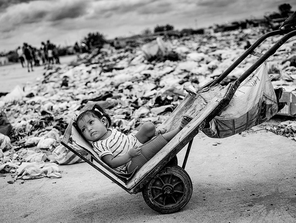 A child on a trolley