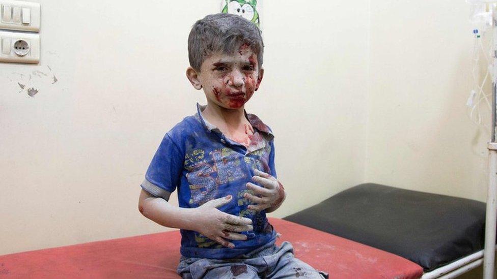 A Syrian boy awaits treatment at a make-shift hospital following air strikes on rebel-held eastern areas of Aleppo on September 24, 201