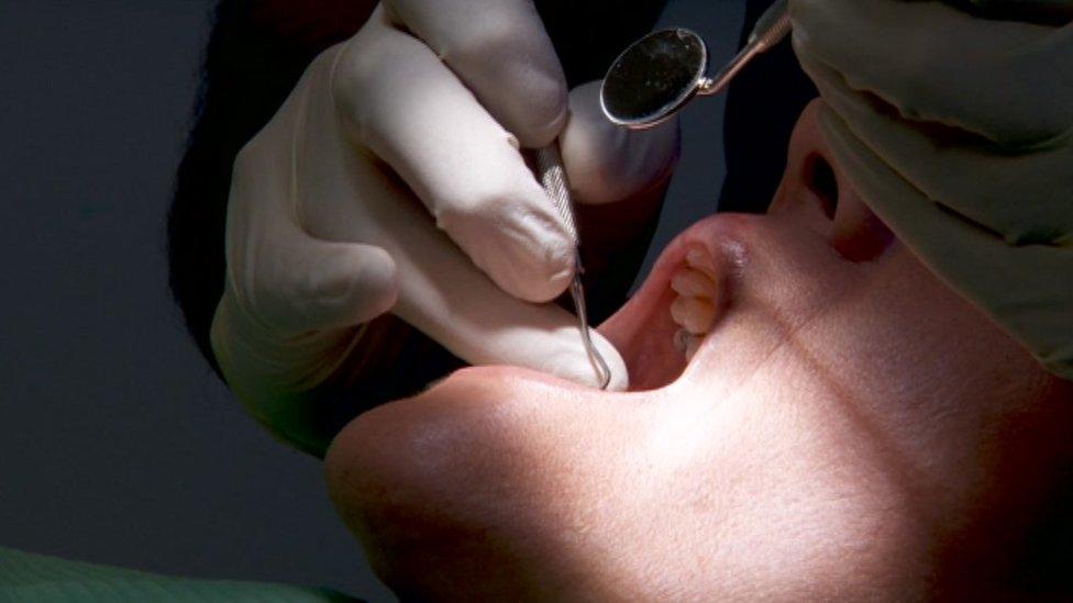 A person in a dentist's chair with their mouth open and a dentist working inside