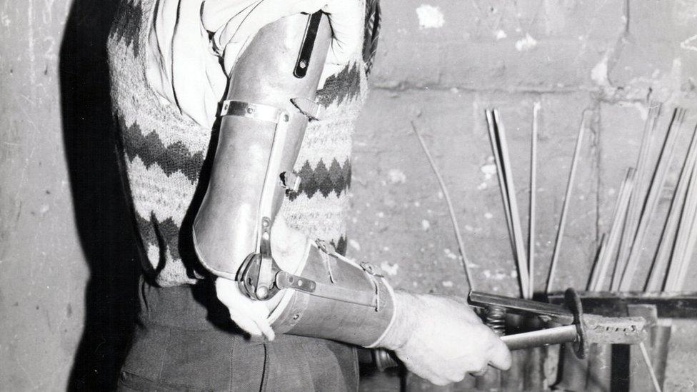 A man with a prosthetic arm