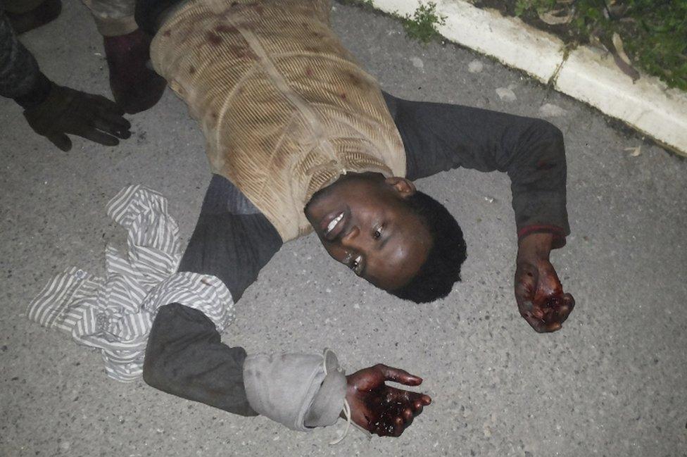 A migrant with wounded hands lies on the ground after crossing over the wall at the Tarajal border in Ceuta, Spain, 17 February 2017.