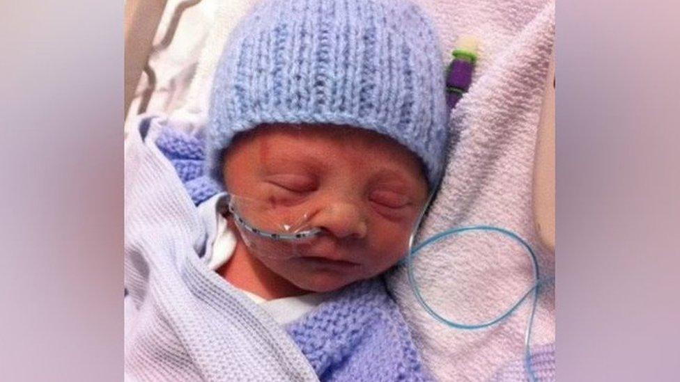 Very small baby with tube in nose wearing woolly hat