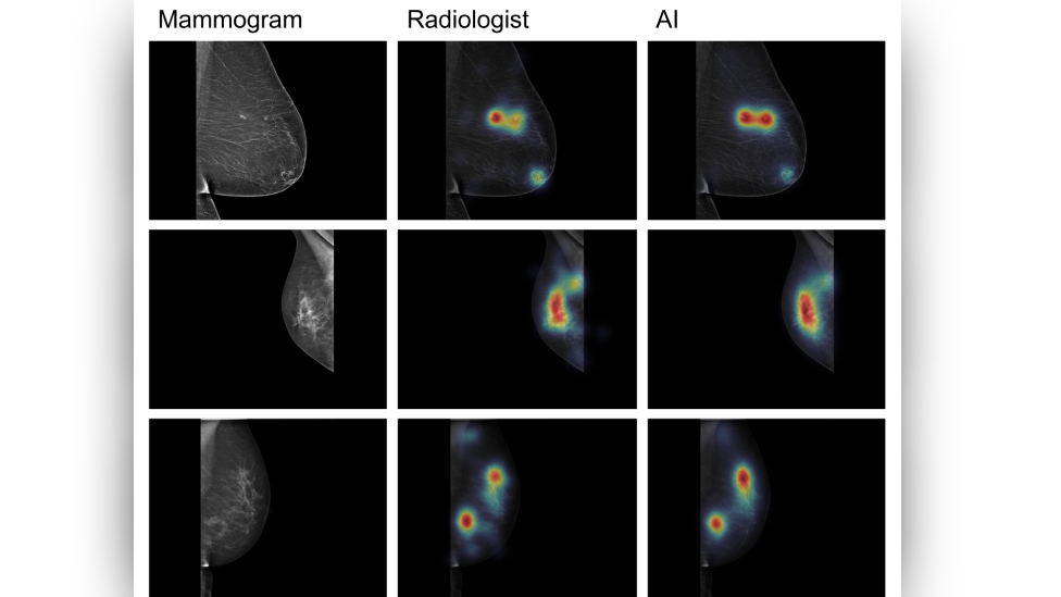 Medical images as seen by AI and a radiologist