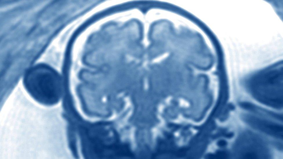 Baby brain