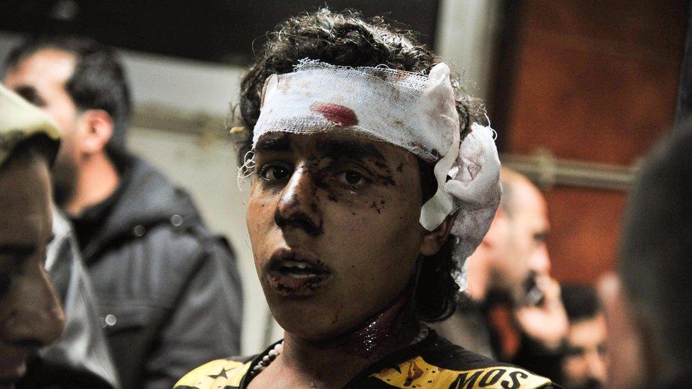 In this photo released by the Syrian official news agency SANA, an injured victim of the triple blast in Sayyida Zeinab, a predominantly Shiite Muslim suburb of the Syrian capital Damascus arrives to a hospital to receives treatment, Syria, Sunday, Feb. 21, 2016.